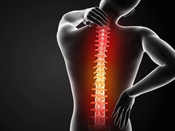Epidural steroid injection
