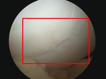 Sports injury treatment